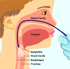 Fiberoptic Laryngoscopy